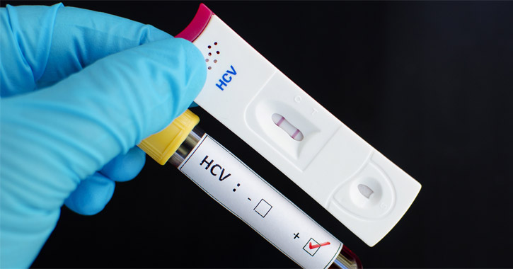 Hepatitis C gyorsteszt és PCR-teszt