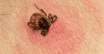 A Lyme-kór tünetei