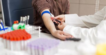 Laborérték-értelmező - Mit mutat az MCH és MCV a vérképben?