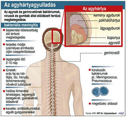 agyvíz