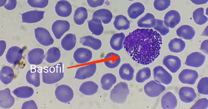 Bazofil granulocita mikroszkópos képe