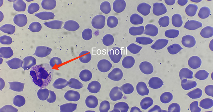 Eozinofil granulocita mikroszkópos képe