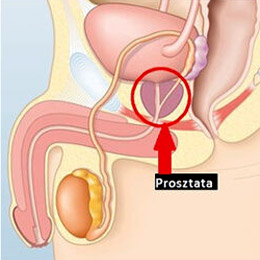 Prosztata anatómiai helyzet